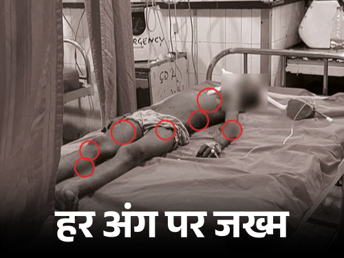 Jalandhar Child Death | Dog Bite Incident Civil Hospital Treatment